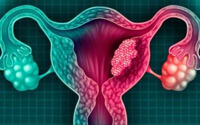 Cáncer de cuello uterino, la primera causa de muerte por cáncer en mujeres