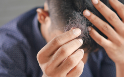 La caída del Cabello: Un problema común pero solucionable